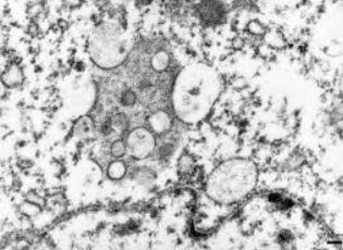 🦠 Deadly Lyssavirus Case Confirmed in NSW: What You Must Know Now